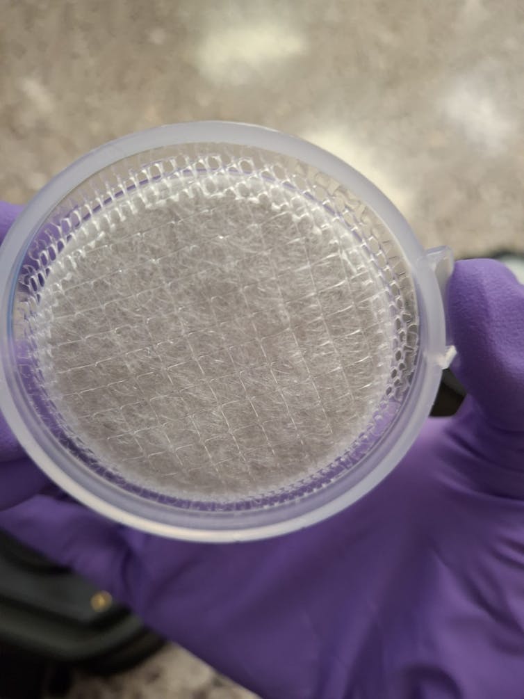 resistencia antimicrobiana contaminación