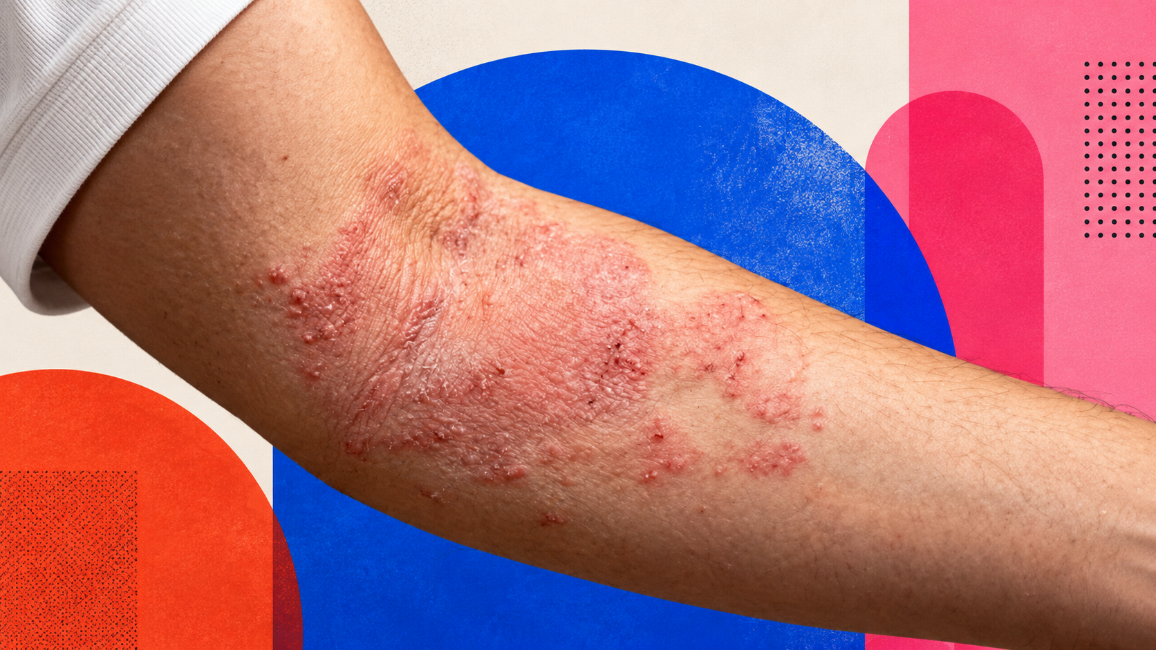 [Foto por: Sanofi]